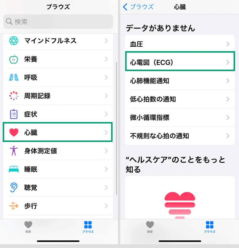 心電図APP