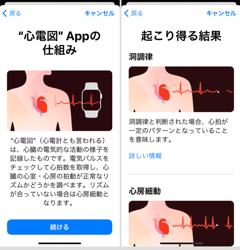 心電図APP　説明